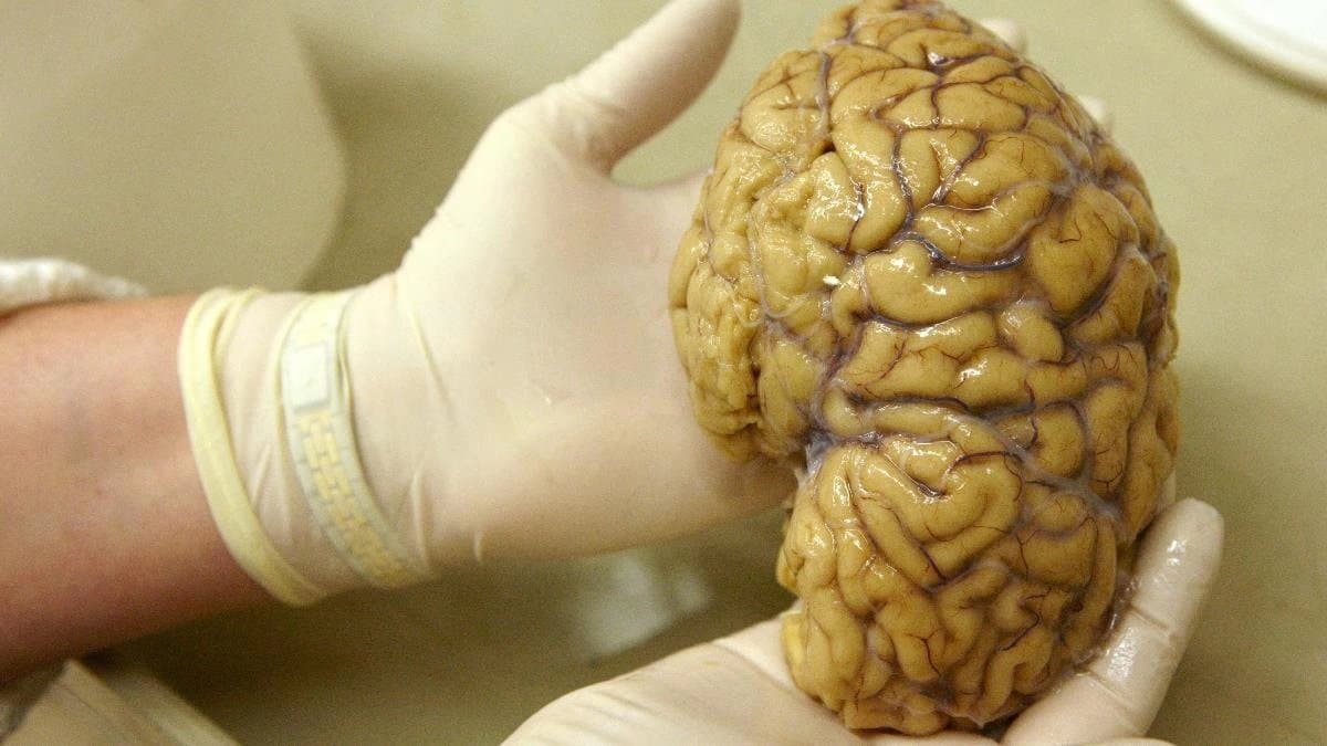 American professor says death is not the end of life and death can be reversed