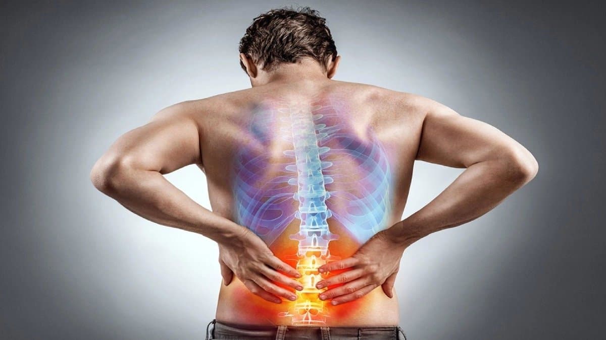 Does sleeping without pillow reduce back pain 