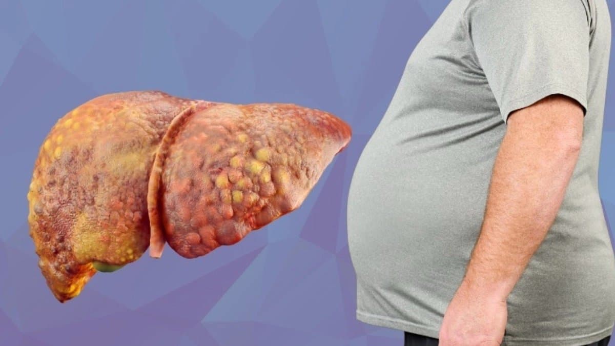 These inexpensive fruits will remove dirt stuck to the liver and prevent fatty liver problems 