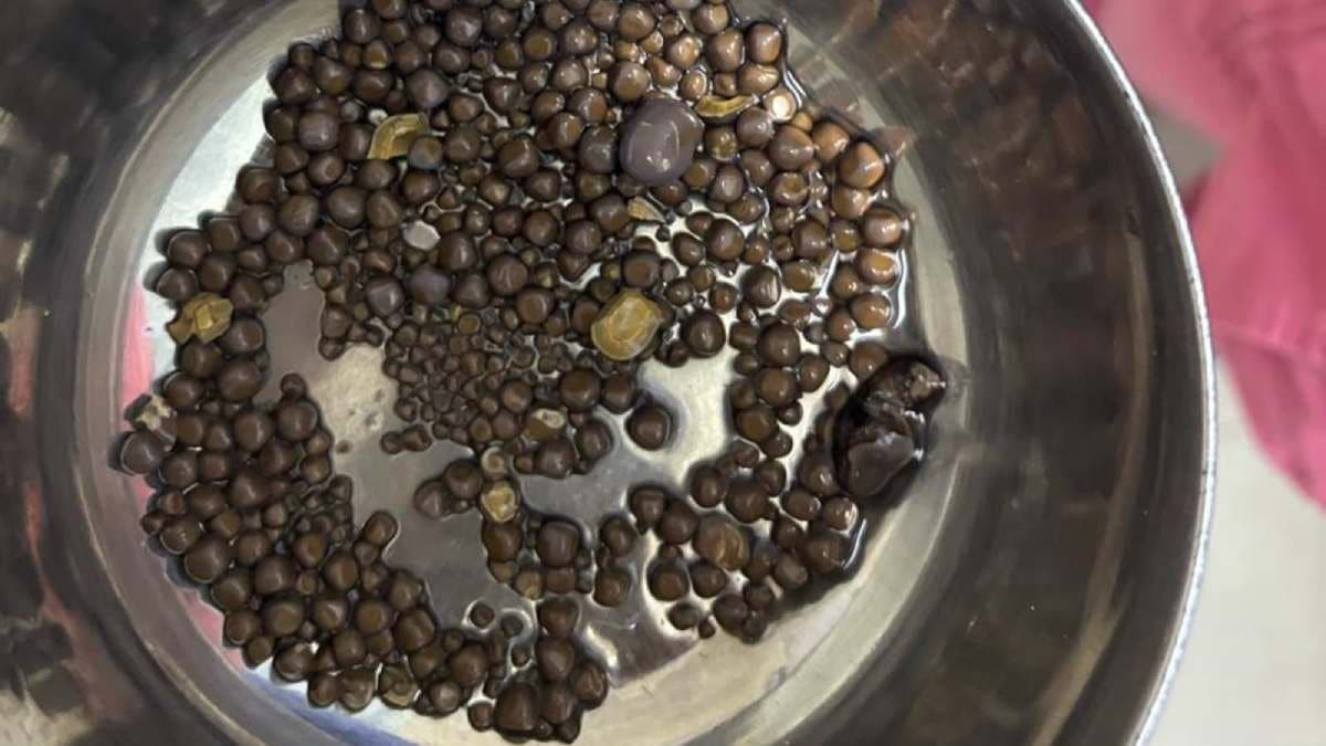 Avoid these Daily foods to reduce kidney Stone chance