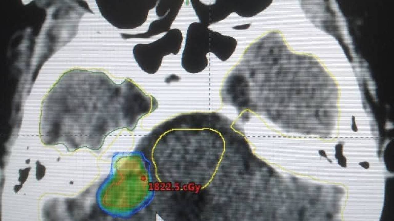 Kolkata Medical College 
 
