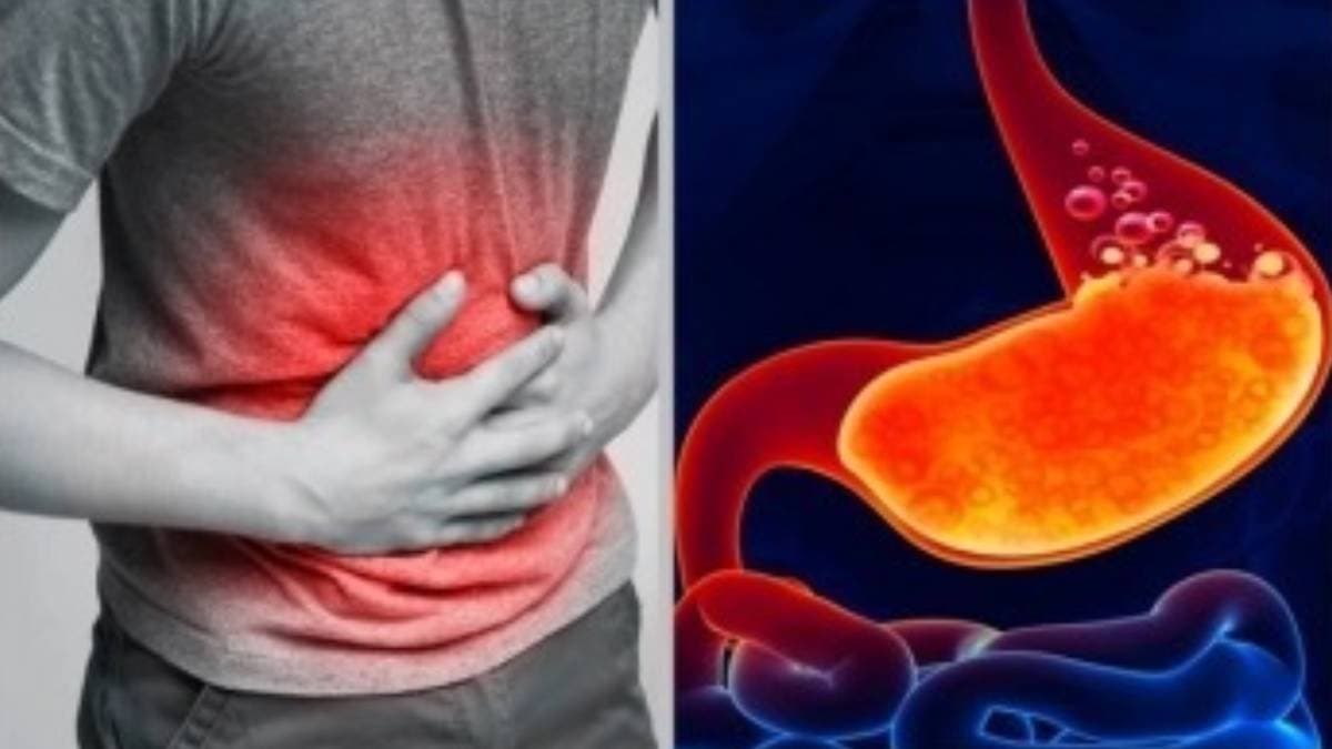 These foods help to reduce indigestion and bloating problem naturally
