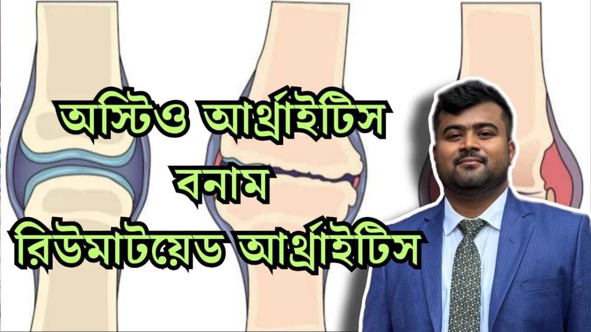 Exclusive: Difference between Osteoarthritis and Rheumatoid Arthritis explained by expert doctor