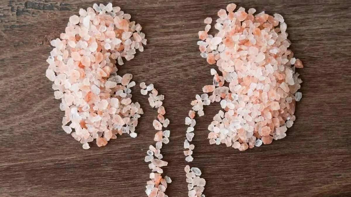 What are the common symptoms of Kidney Stones