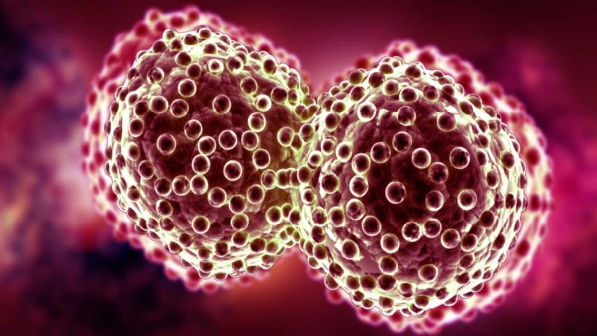 People staying near river drainage are more vulnerable to cancer