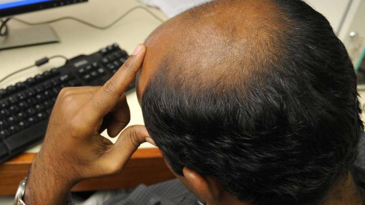 Pumpkin seeds can help to reduce hair Loss and Baldness