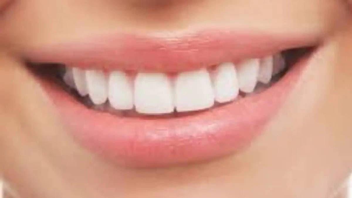 How to take care of teeth know the tips