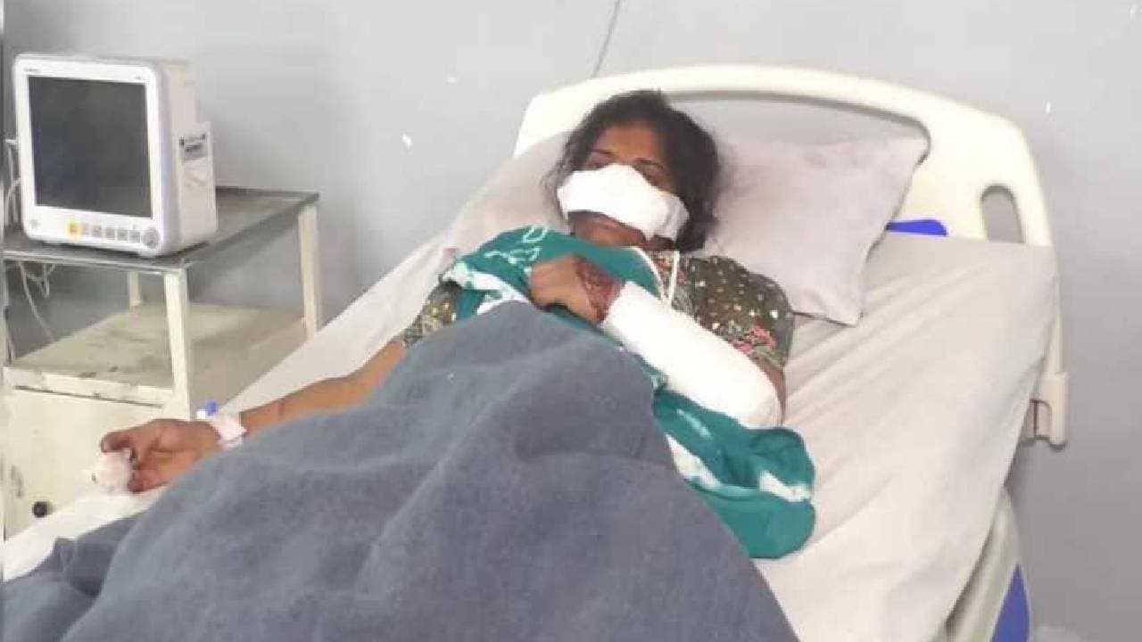 Madhya Pradesh Man Cuts Off Wifes Nose Over Suspected Infidelity 