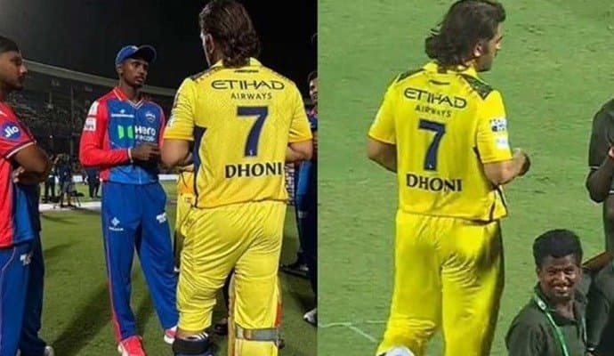 MS Dhoni: পায়ে আইস প্যাক নিয়ে ফটোসেশন, আইপিএলের বাকি ম্যাচে পাওয়া যাবে ধোনিকে? 