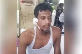 Youth bite shopkeeper for refusing to give cigarette 