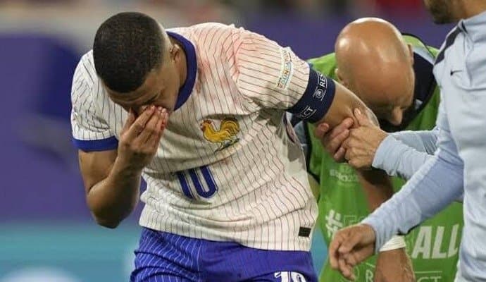 Kylian Mbappe: নাক ভেঙেছে, তবে এখনই অস্ত্রোপচার নয়, মাস্ক পরে খেলবেন এমবাপে!