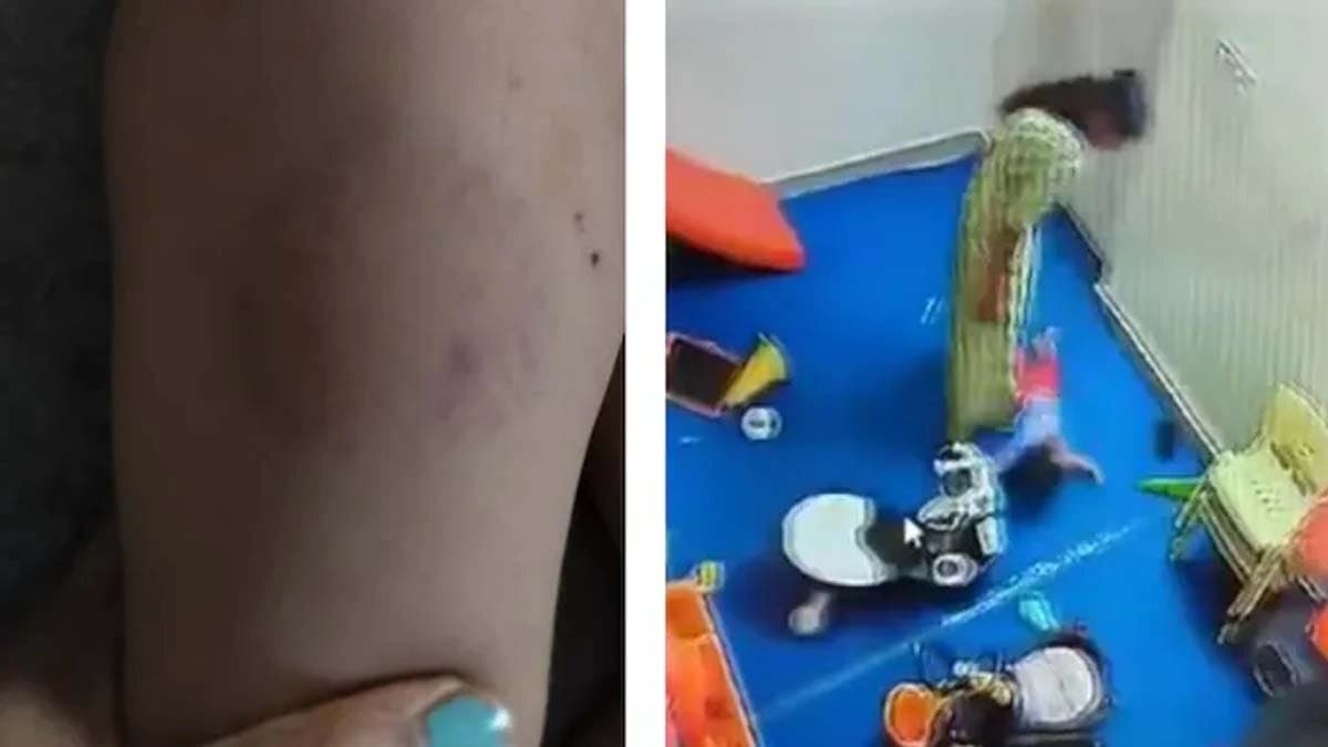 Child brutally tortured in day care slapped thrown to the ground bite marks found on body shock in Noida