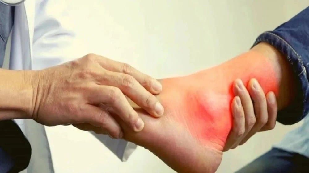 Apple Cider Vinegar with warm water will disappear uric acid automatically