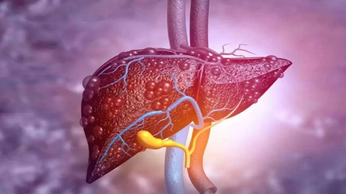 Two promising drugs on liver cirrhosis