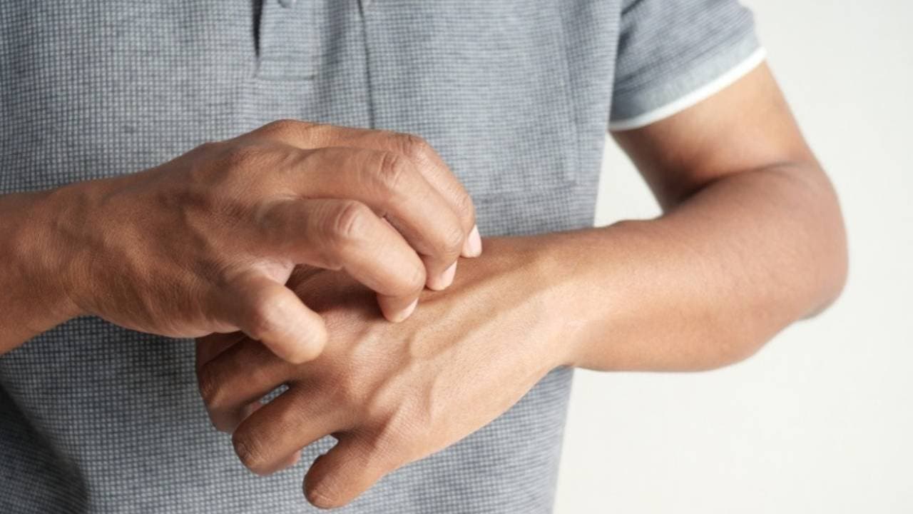 Diabetes Symptoms: Your skin can reveal early signs of diabetes