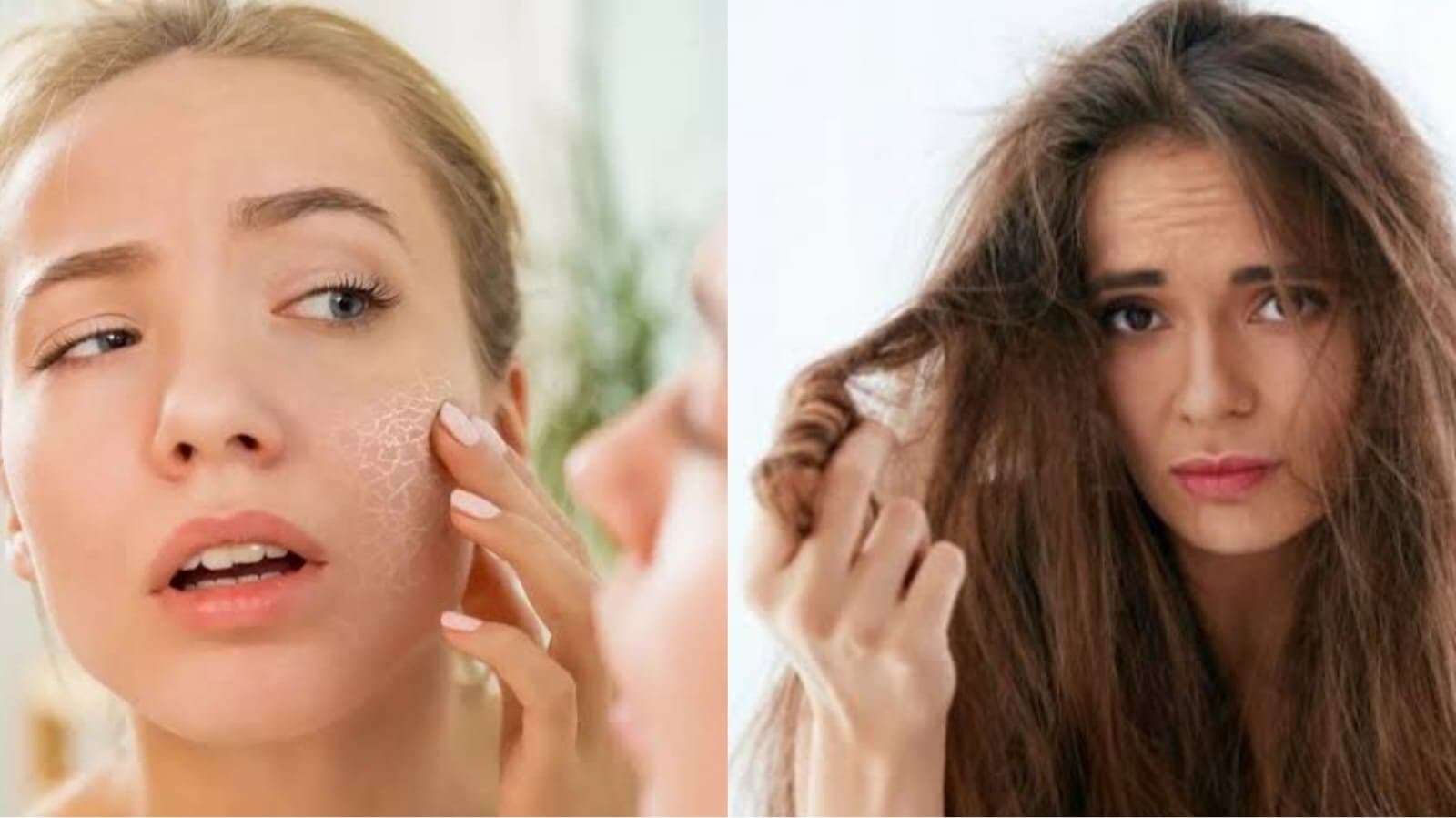 Easy home remedies for skin and hair care