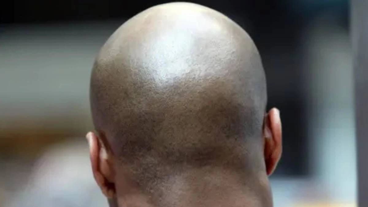 Callin man bald is crime in UK