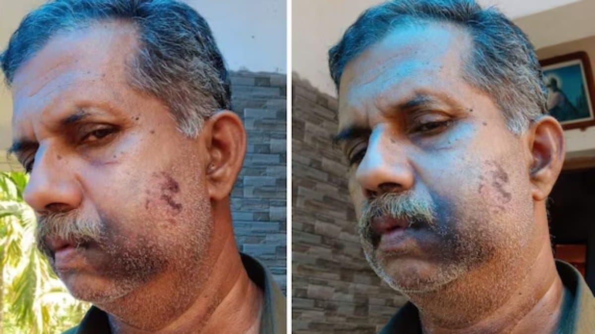 Kerala man assaulted by former classmates during reunion over a five decades old dispute