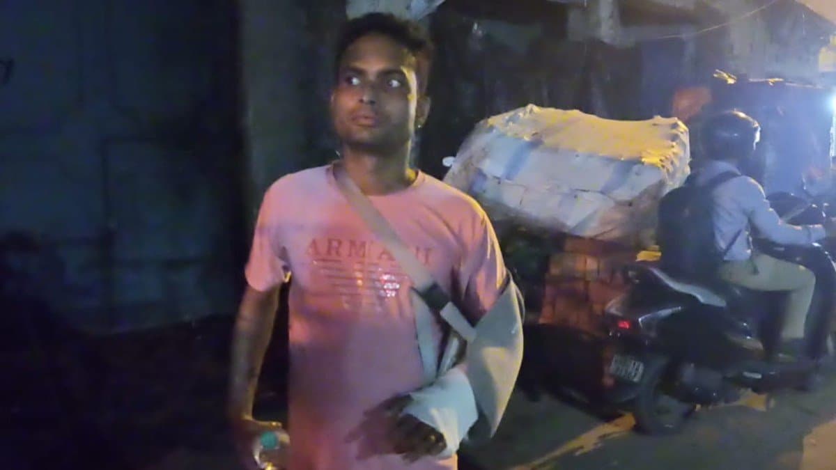 Doctors of SSKM successfully restored chopped hands of a youth gnr