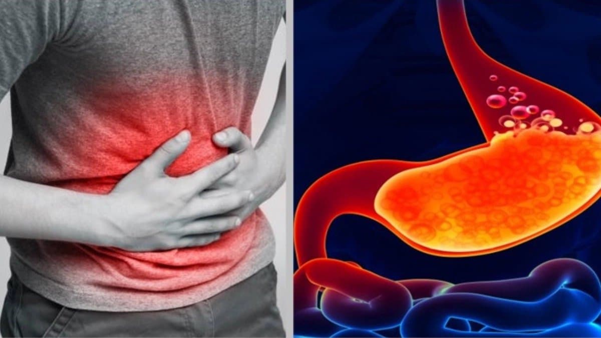 Not only gas these diseases can be the reasons of frequent bloating