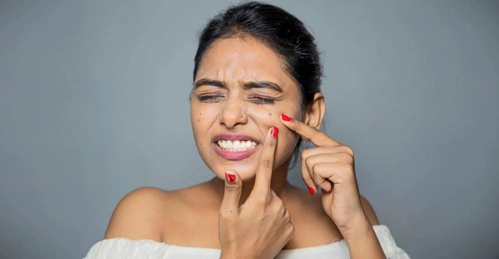 Skin Care Tips: These three foods you should avoid if you have acne