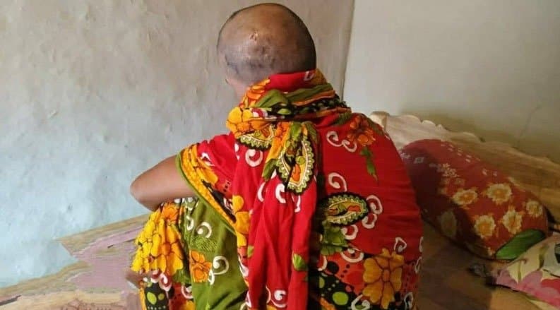 Assault: মান্যতা নেই এই বিয়ের, সালিশি সভার বিচারে দম্পতির চুল কেটে জুতোর মালা পরিয়ে ঘোরানো হল গ্রামে!