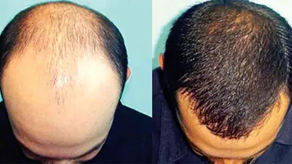 This hair oil helps to grow hair quickly