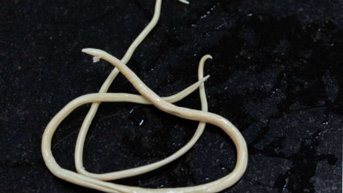 worms have bad effects on health from child to adults body lif