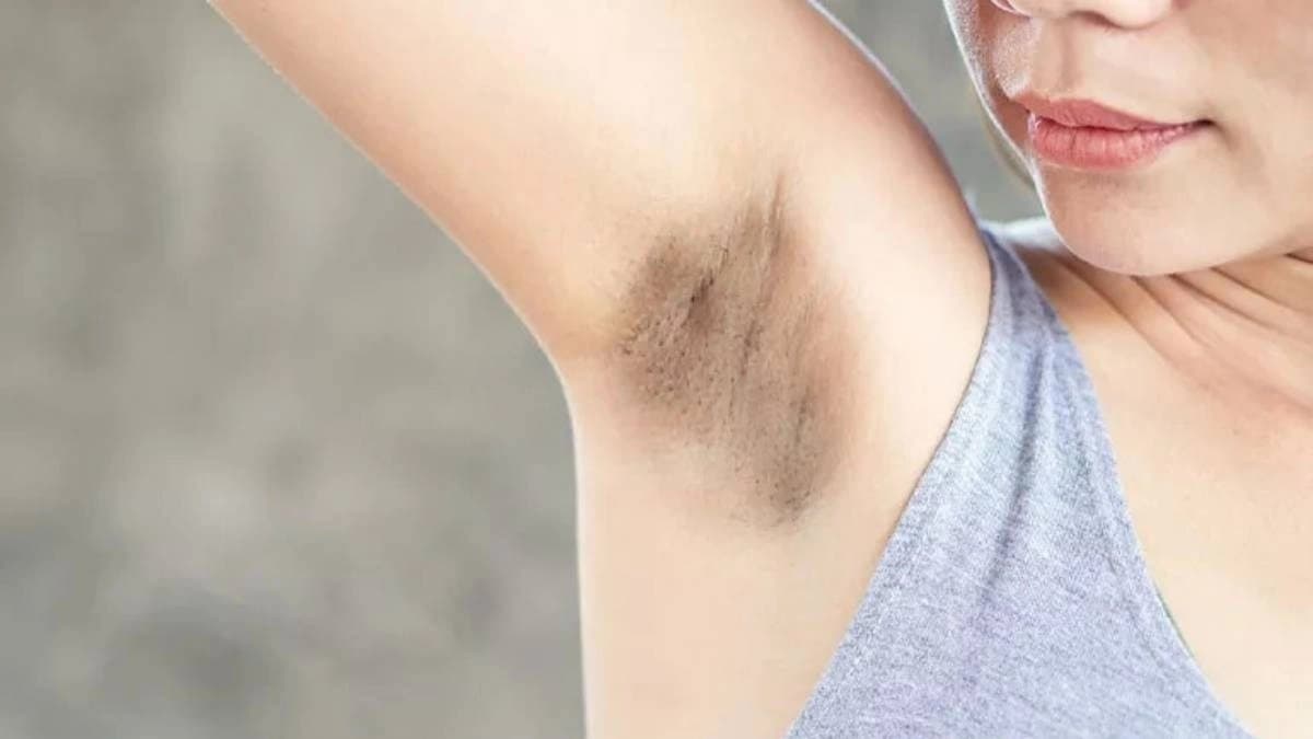These easy steps help to get rid of underarm blackness in no time