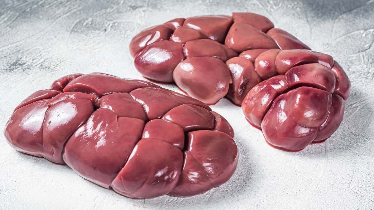 Bloody urine and pain among top symptoms of kidney Stone