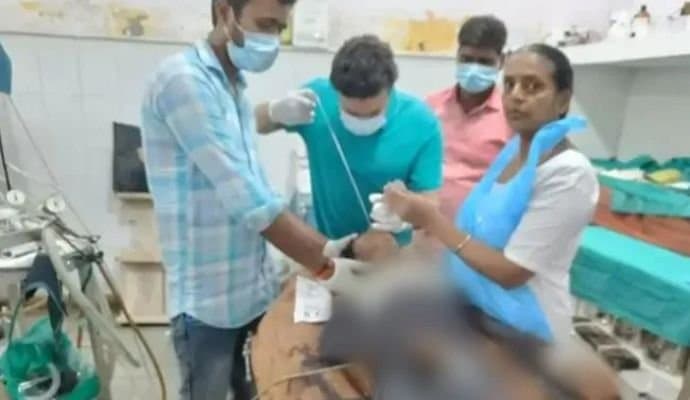 Coin Stuck In Throat Of a Boy, Removed After 7 Years