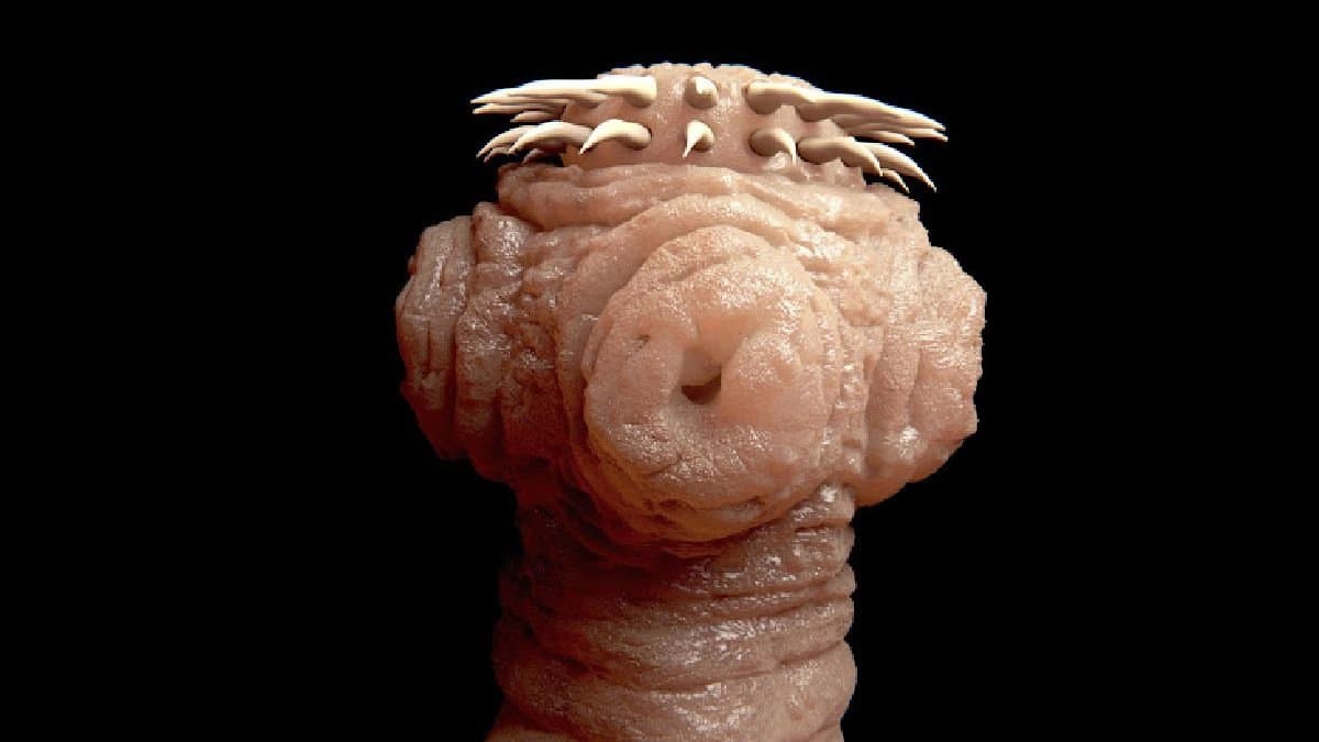 Tape worm infestation is spreading in Monsoon symptoms and prognosis