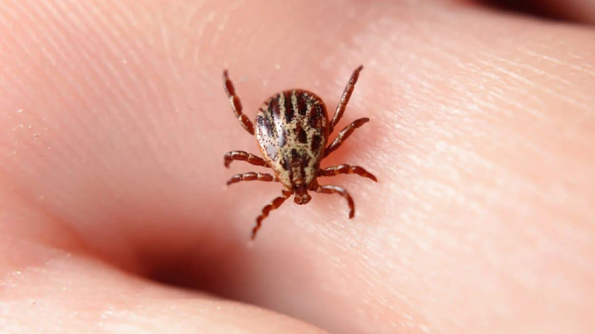 Did you know about these home remedies to get rid of ticks