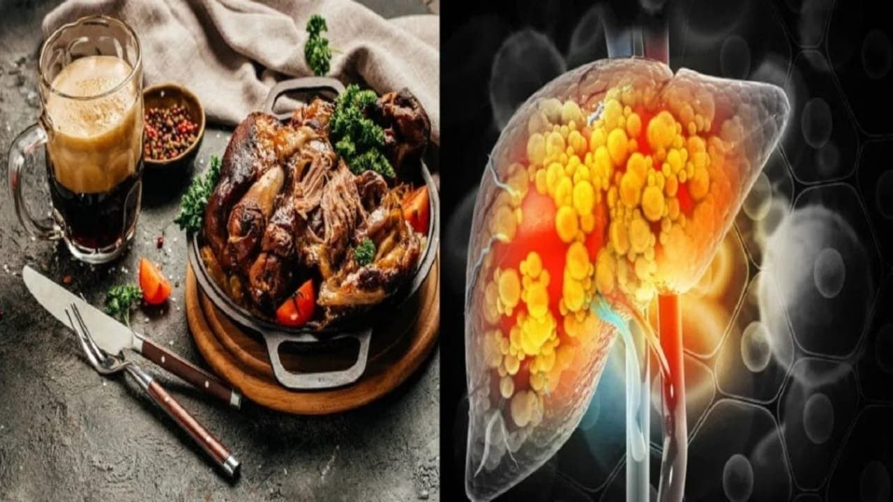 Not Just Alcohol these five Foods are dangerous for liver and fatty liver may occur 