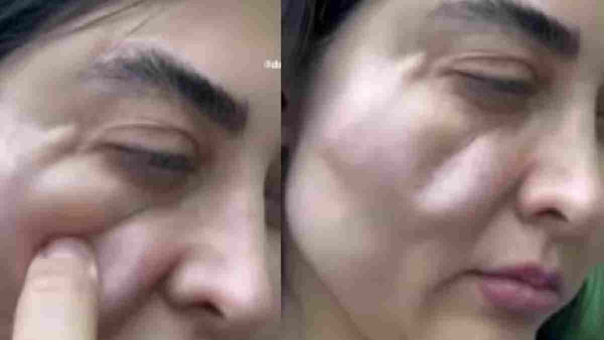 botched cosmetic surgery side effects