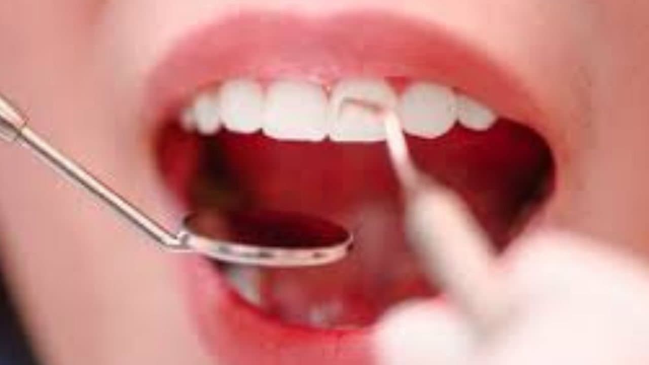 How to keep your teeth enamel intact know from the expert