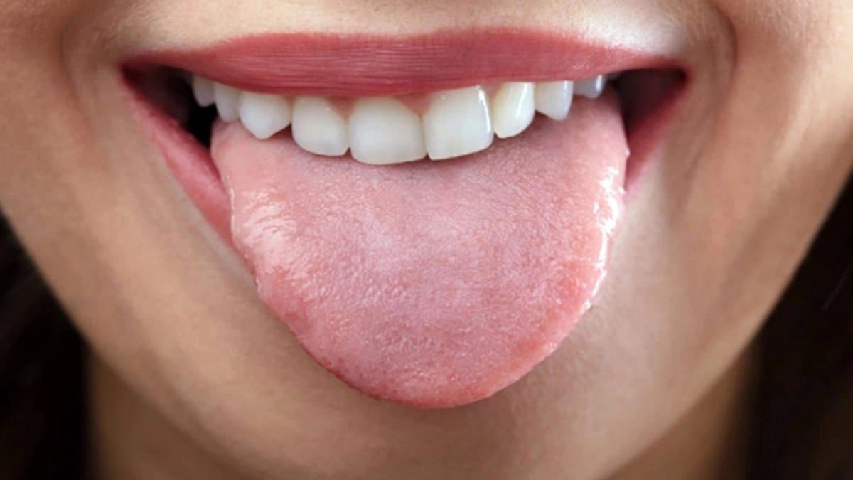 Health Tips: Your tongue can tell critical condition of your health