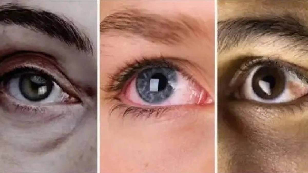 These eye symptoms can reveal your health 