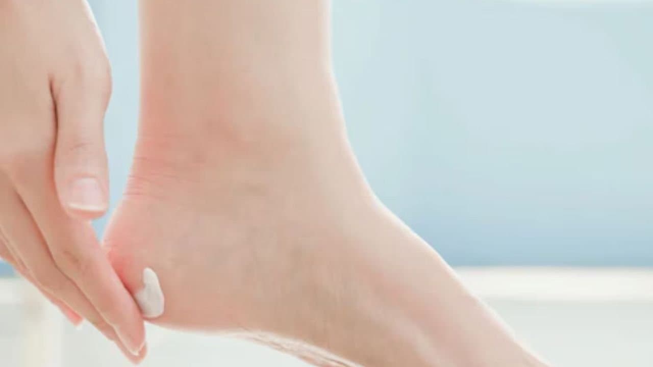 How to heal cracked heels with home remedies