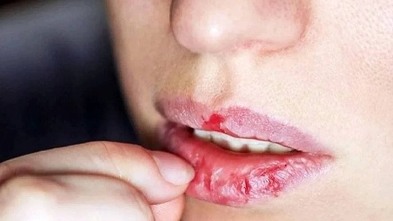 These Simple Home Remedies Keep Your Lips Soft Pink and Hydrated