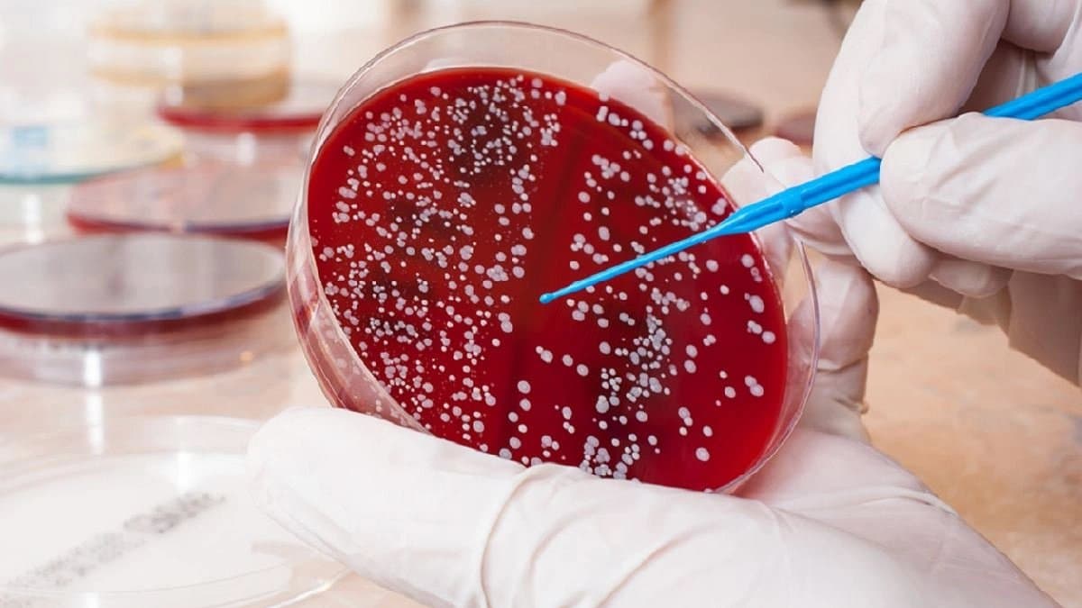 Early symptoms of leukemia or blood Cancer