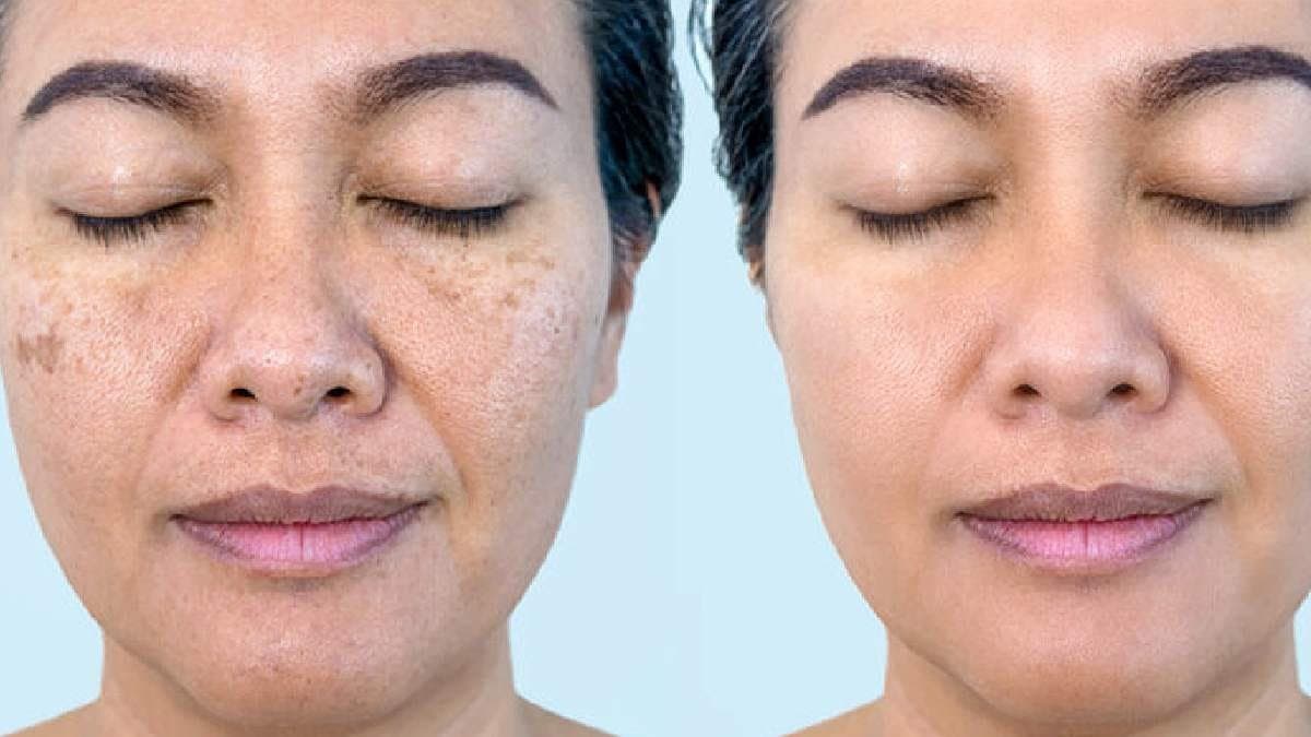  Rose petals are useful for improving dark spots and make your skin tone bright and shiny lif 