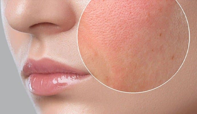 Skin Care: তাপমাত্রার দাবদাহে ডিহাইড্রেটেড হচ্ছে ত্বক? ঘরোয়া উপায়ে সমাধান করবেন কীভাবে? 