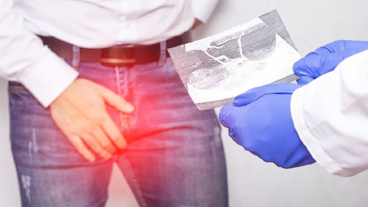 Man suffers from rare disease of having a single testicle