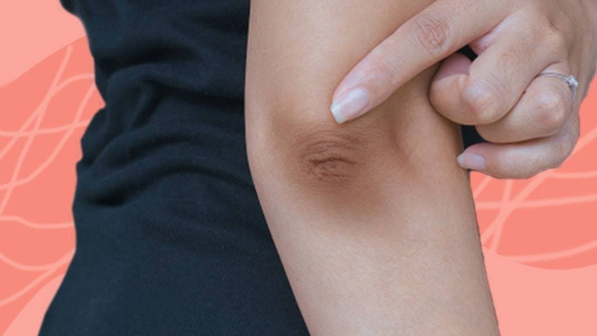 this home made natural remedy can prevent the black spots of your elbow and make them healthy and brightening lif