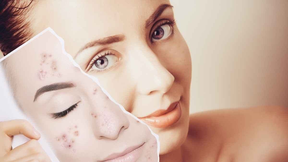 this home made natural face pack can remove sun tan wrinkles and make your skin glowing lif 