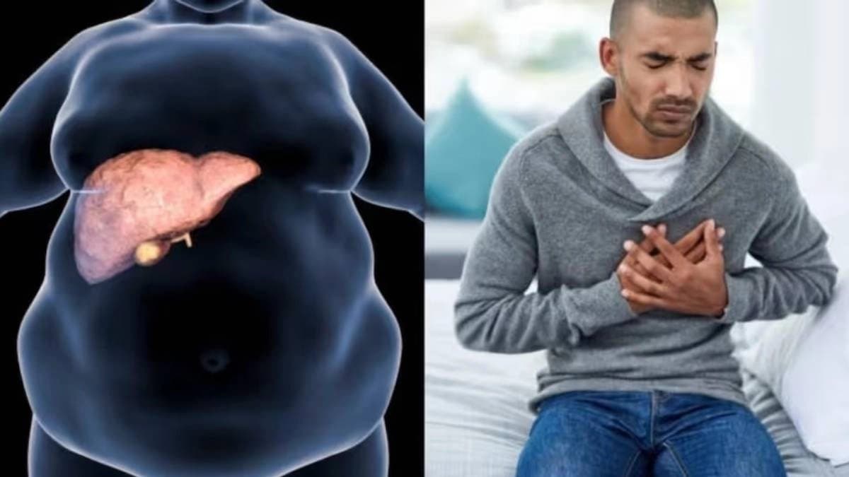 Avocado is packed with healthy fat which protect heart liver and has many benefits 