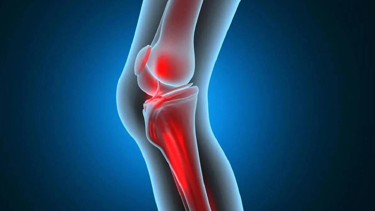 Health tips foods to keep bone strong