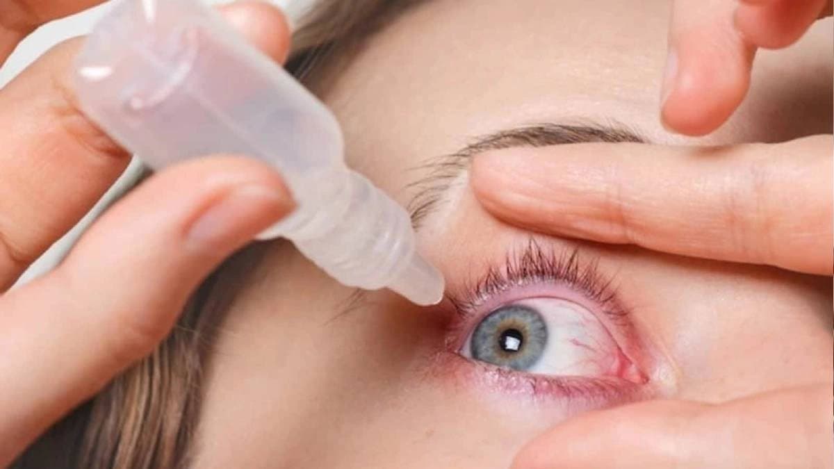 How to avoid eye infection in monsoon
