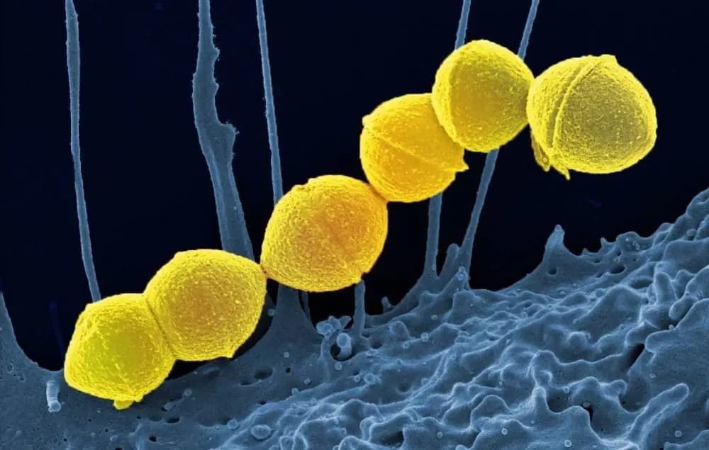 Rare flesh-eating bacteria abnormally rises in Japan, capable of killing within 48 hours